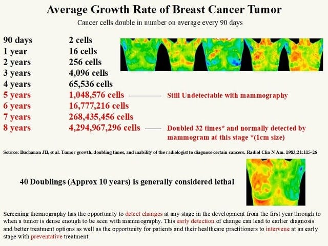 Thermography breast cancer tumor