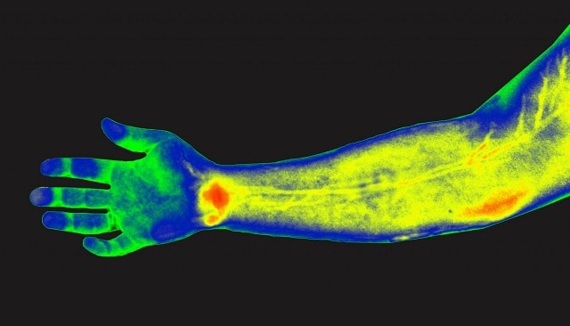Thermography arm