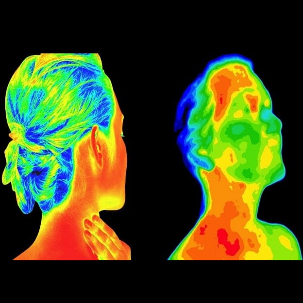 Thermal-Imaging-An-Exciting-Progression-in-the-Treatment-of-Head-Neck-Care featured