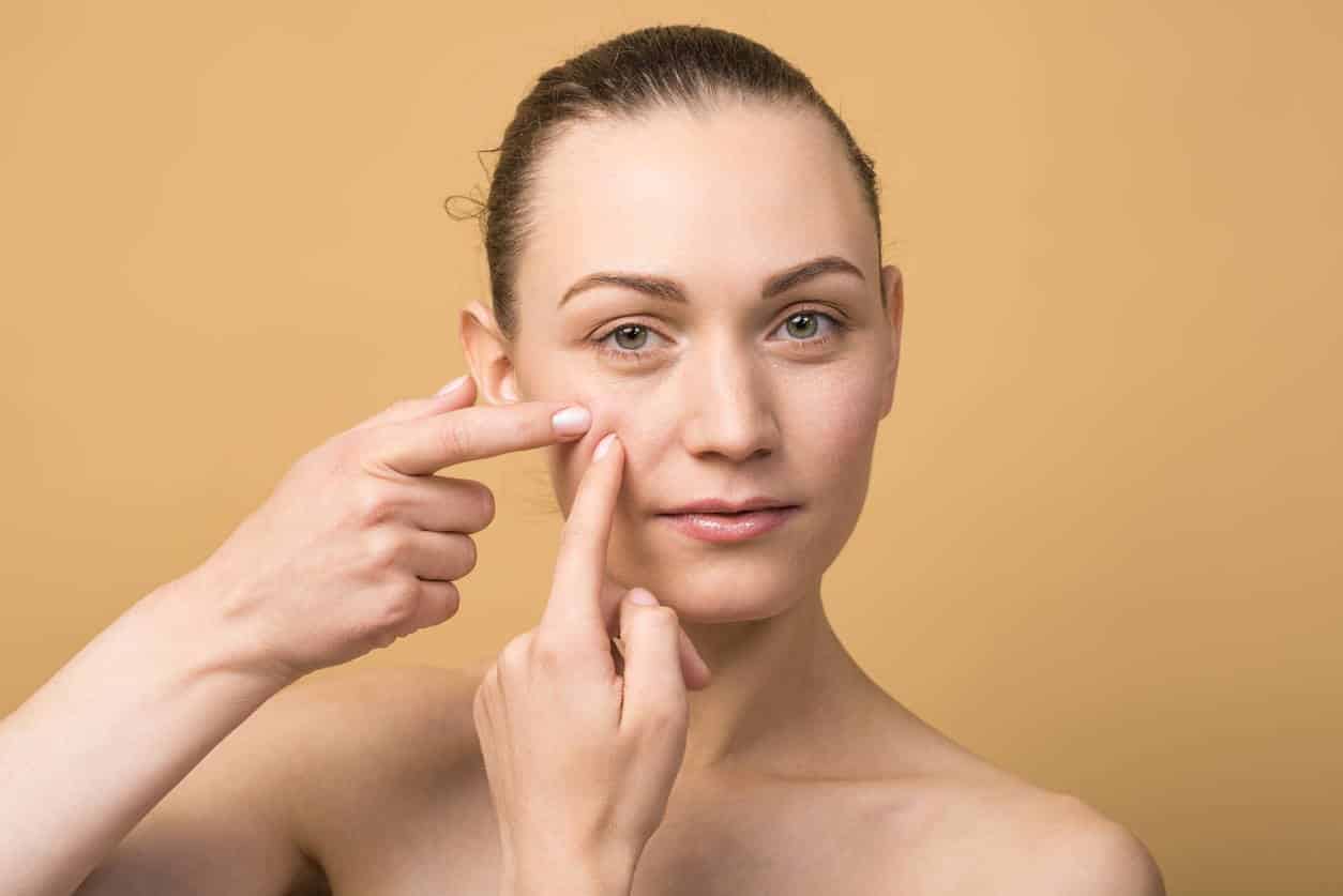 Pretty caucasian girl squeezing a pimple on her cheek isolated on a beige studio background. Skin care concept.